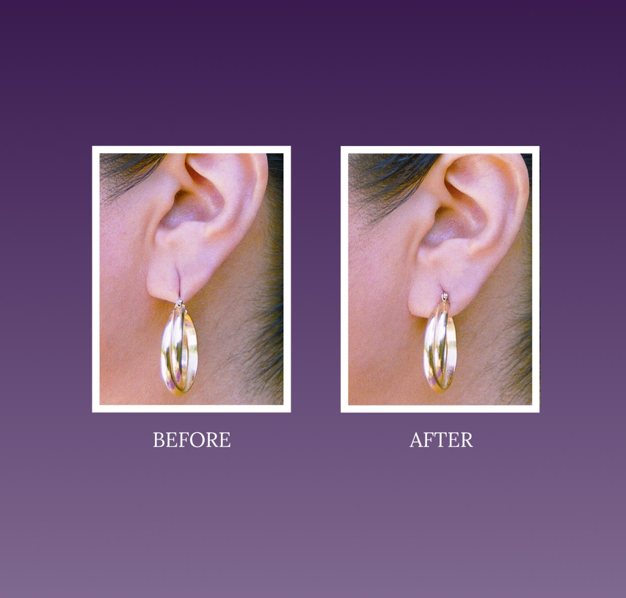 LOBE WONDER (60 Patches) - The ORIGINAL Ear Lobe Support Patches for Pierced Ears