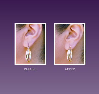 LOBE WONDER (60 Patches) - The ORIGINAL Ear Lobe Support Patches for Pierced Ears